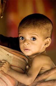 Malnutrition the state of Children and Women in India